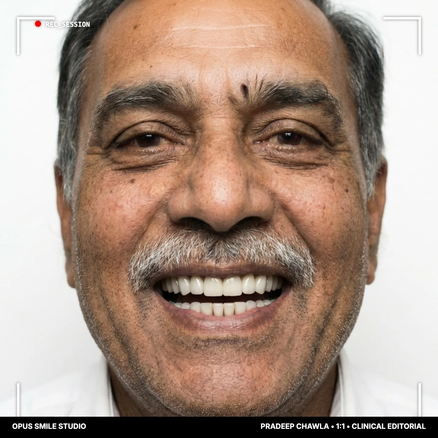 Pradeep after 