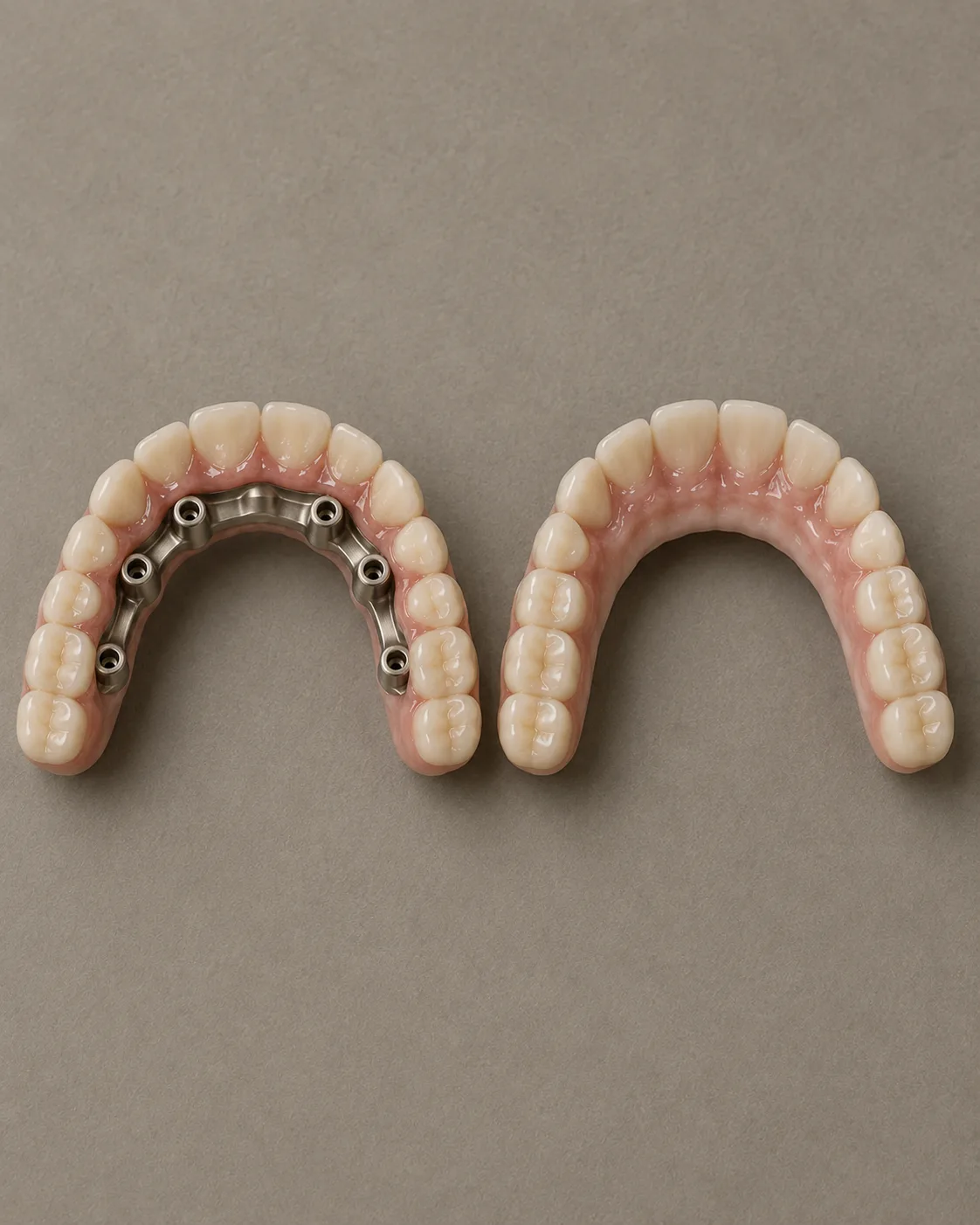 Two full-arch bridges side by side: acrylic teeth on a titanium bar, and a zirconia arch with pink porcelain gum