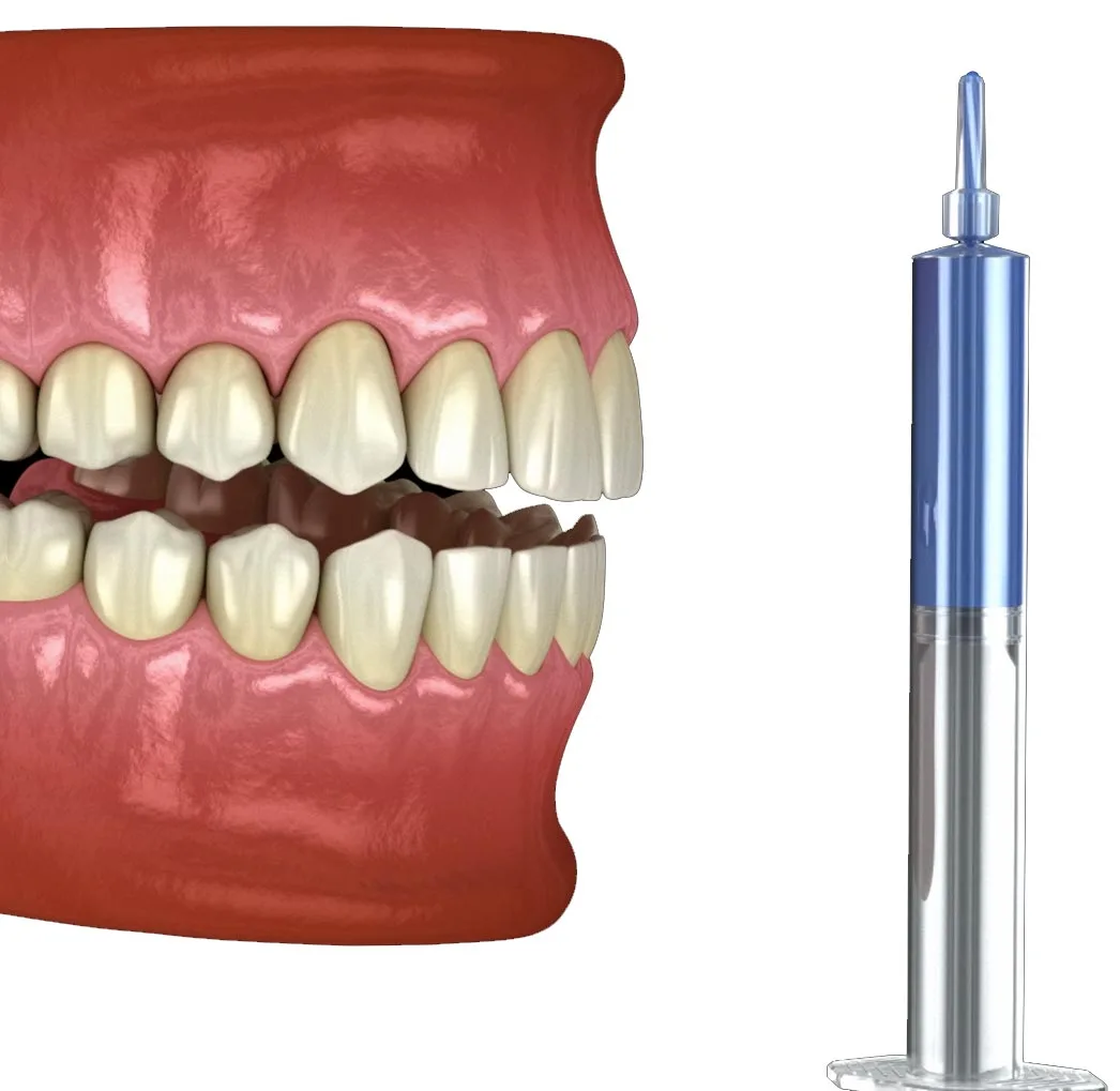 Teeth Whitening in Turkey: Cost, Methods and Is It Worth the Trip?