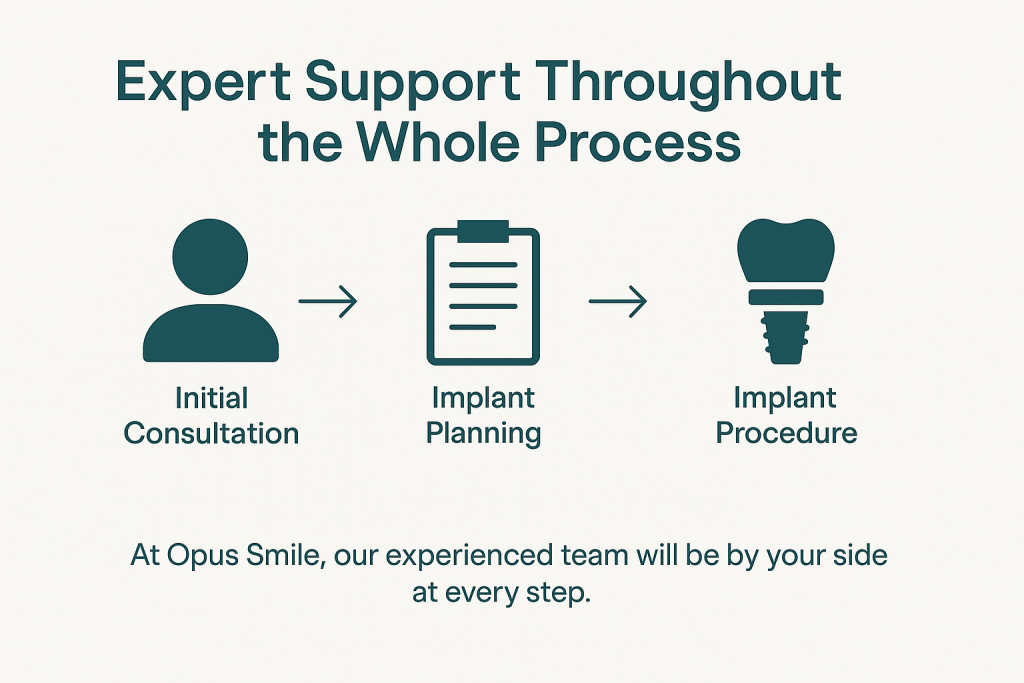 Clean infographic illustrating Opus Smile’s expert support throughout the dental implant process, featuring clearly labeled treatment stages and minimalist icons for patient-focused care.